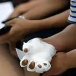 Pirotecnia en Salta: cuatro menores de edad tuvieron que ser atendidos por quemaduras