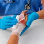 Dónde concurrir ante emergencias por quemaduras para el Año Nuevo